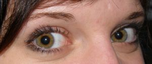 eyes